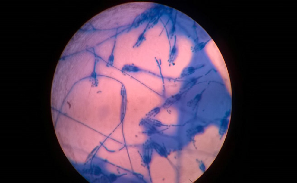 Paecilomyces lilacinus hyaline septate hyphae with elongated, tapering phialides with several elliptical conidia.