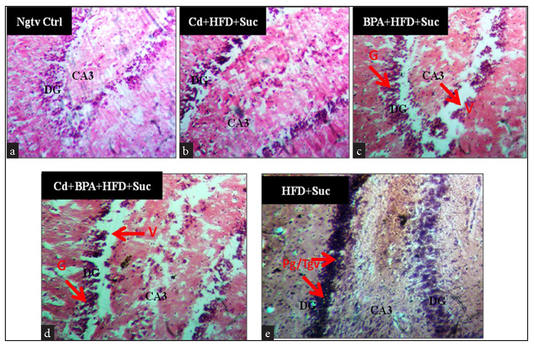 Representative light micrograph of the dentate gyrus of all groups exposed for 56 days. (a) Ngtv Ctrl (x100), (b) Cd+HFD+Suc (x200), (c) BPA+HFD+Suc (x200), (d) Cd+BPA+HFD+Suc (x200) and (e) HFD+Suc (x200).Stain: H&E. BV: Blood vessel, G: Granule cell, V: Vacuolation, Nbv: Necrotic blood vessel, Cl: Clumping, Tg: Tangling, Pg: Deeply pigmented cells, H&E: Hematoxylin and eosin, DG: Dentate gyrus, CA3: CA3 region, Ngtv ctrl: Negative control group, Cd: Cadmium, HFD: High-fat diet, Suc: Sucrose drink, BPA: Bisphenol-A, Red arrows: pointing to the cells/features of interest.